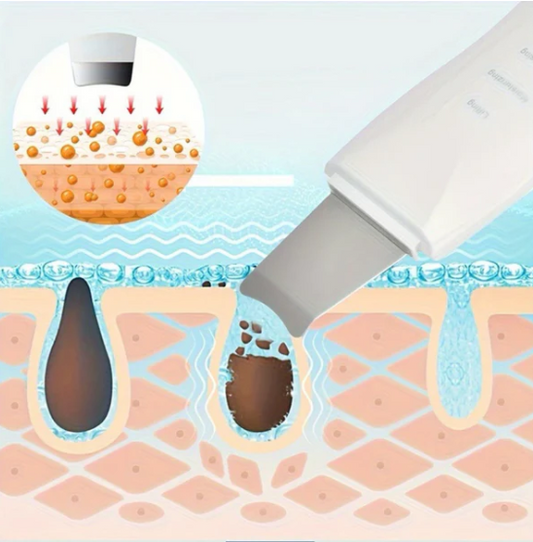 ESPATULA PEELING ULTRASONICA 💆🏻♀️✨ - ENVÍO GRATIS ⭐